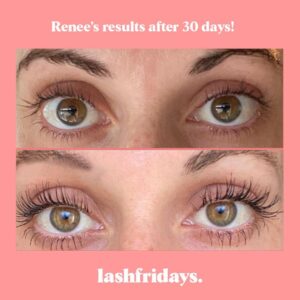 EYELASH SERUM - LashFridays