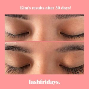 EYELASH SERUM - LashFridays